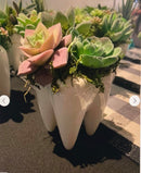 Ceramic Tooth Vase: Dental Planter, Dentist Gift