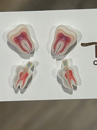 Nerve and Root Canal Earrings