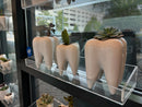 Ceramic Tooth Vase: Dental Planter, Dentist Gift